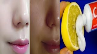 रात में 1 बार लगालो चेहरा इतना गोरा खूबसूरत हो जाएगा दुनिया देखती रह जाएगी | skin whitening at home