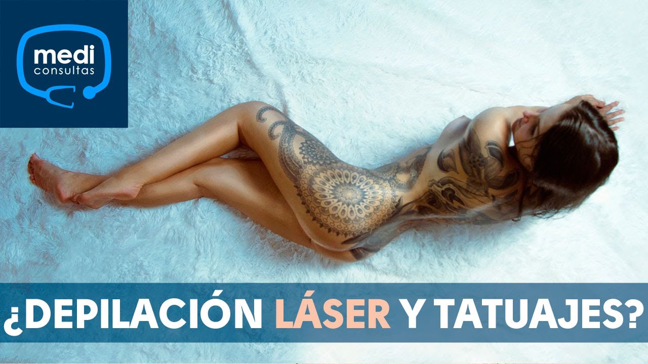 Depilación láser y tatuajes ¿son compatibles? - YouTube