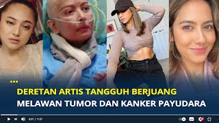 Deretan 6 Artis Berjuang Melawan Tumor dan Kanker Payudara, Ada yang Sehat hingga Kini