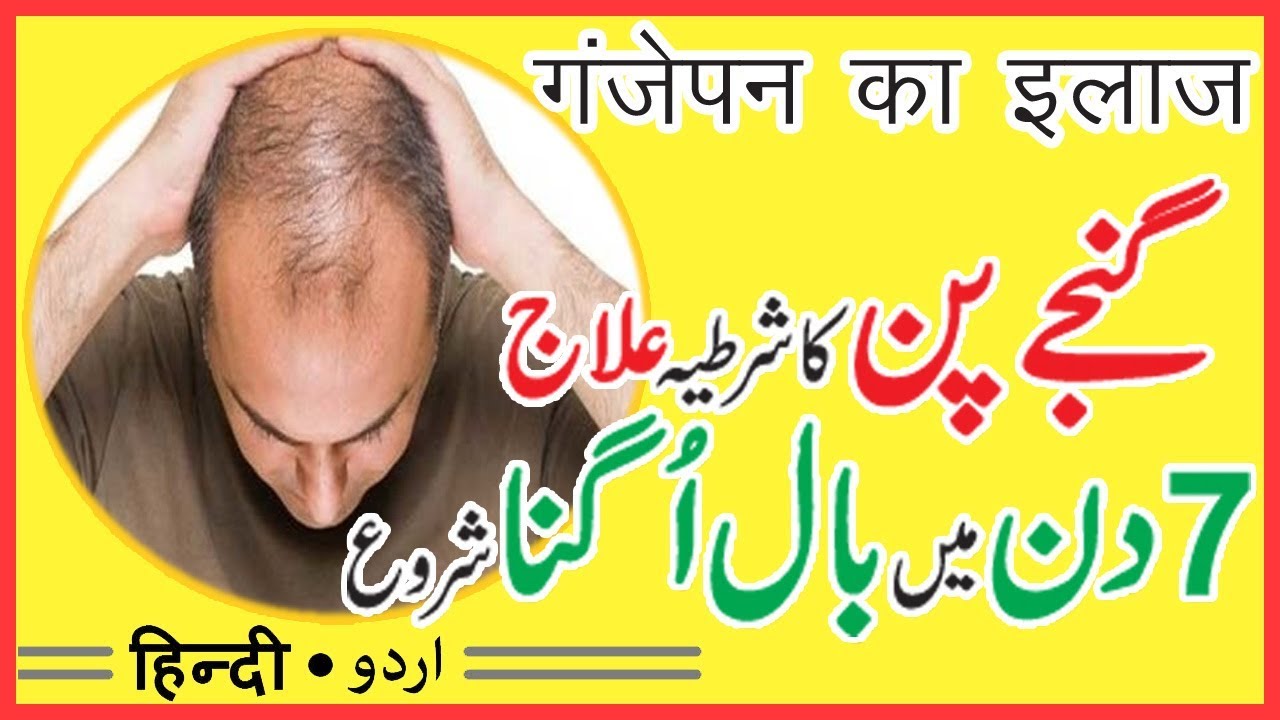 ganjapan dur karne ke liye | ganjapan se chutkara | by sanam video editing software free