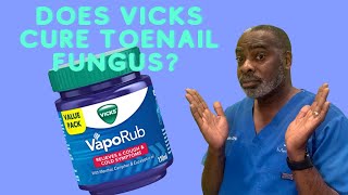 Does Vicks Cure Toenail Fungus?