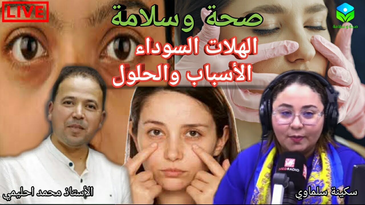 🔴 الهالات السوداء الأسباب والحلول وعلاقتهم بالتغذية 🍐🍏🍊 الأستاذ محمد أحليمي أخصائي تغذية صحية