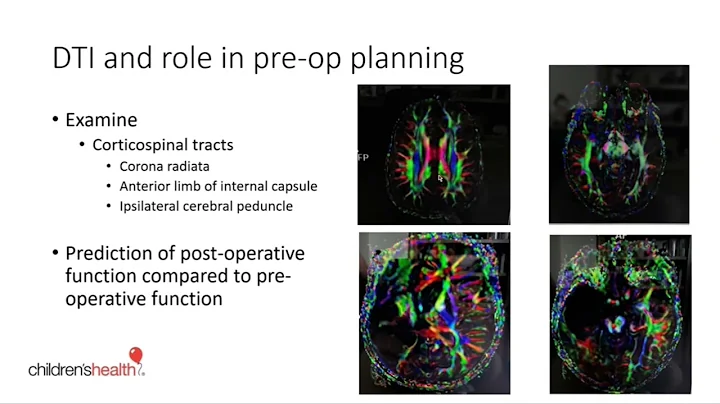 UT Southwestern Neurosurgery Faculty Lecture Serie...