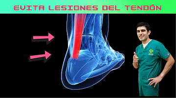 ¿Cómo mantener fuertes los tendones?