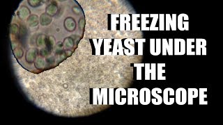 Detailed Yeast Freezing Under The Microscope Information