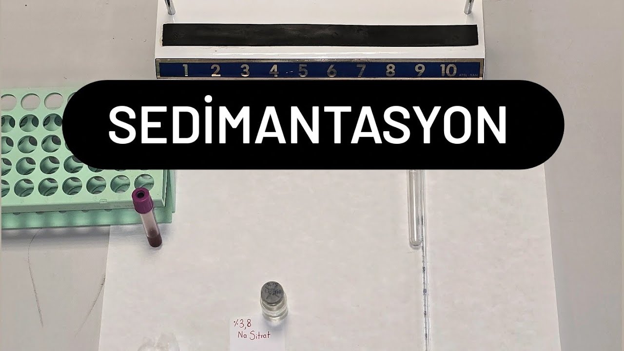 Sedimantasyon Deneyi (ESR)
