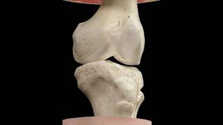 Autograft - 3D Medical Animation Autograft Vs Cadaver Graft Shorts