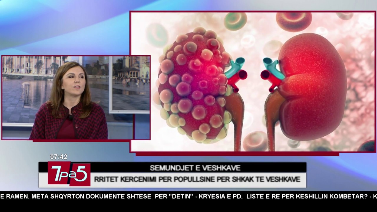 7pa5 - Sëmundjet e veshkave - 8 Mars 2018 - Show - Vizion Plus