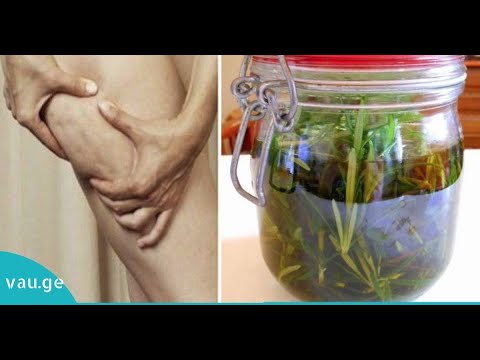 როგორ მოვამზადოთ როზმარინის სპირტი, რომ თავიდან ავიცილოთ პოდაგრა, ვარიკოზული ვენები და ცელულიტი!