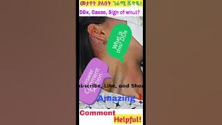 Amazing Short Video, DDx, Cause, Sign of... #shorts #shortsfeed #viral #JVD #amazing #jvd