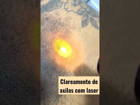 CLAREAMENTO DE AXILAS