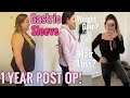 GASTRIC SLEEVE SURGERY| 1 YEAR POST OP - WEIGHT GAIN, HAIR LOSS, LOOSE SKIN