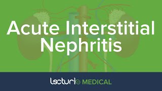 Acute Interstitial Nephritis | AKI | Nephrology