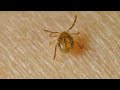 CDC Reports Record High Tick Illnesses