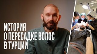 Это история о моей пересадке волос в Турции