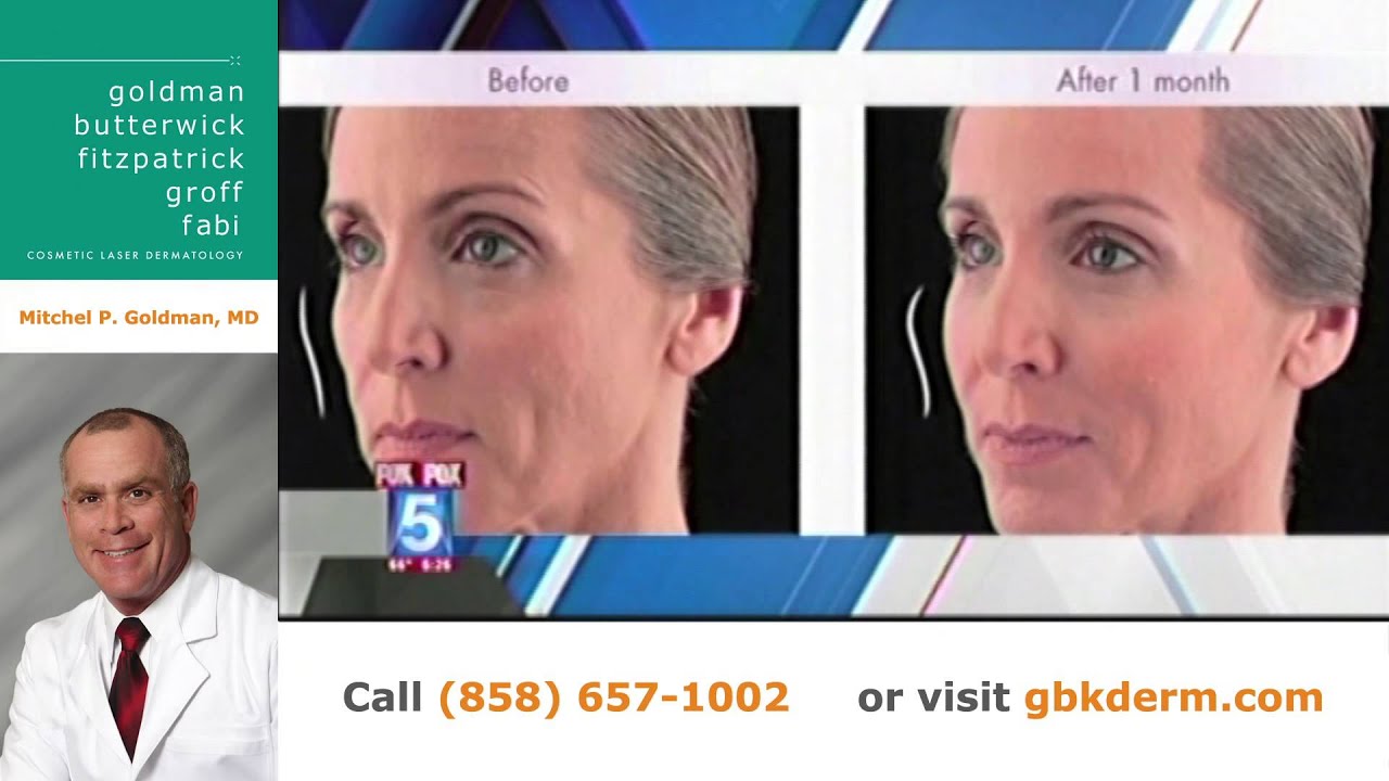 Banner for San Diego Voluma Filler FDA Approved for Cheek Enhancement | Dr. Goldman