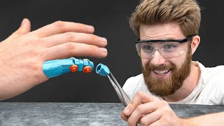 Neuen Finger für Zuschauer bauen! (3D-Druck Prothese)