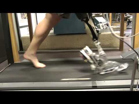 Smart prosthetic ankle takes fear out of rough terrain, stairs 