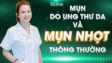 Phân biệt mụn thông thường và mụn do ung thư gây ra| Ds. Cao Hoa