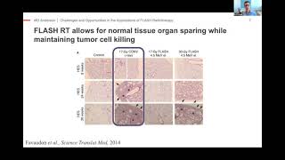 Challenges and Opportunities in the Applications of FLASH radiotherapy
