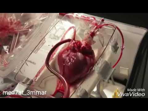 موجوع قلبي حزين حالات واتس اب