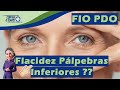 Como reduzir a FLACIDEZ nas PÁLPEBRAS Inferiores ? Fio PDO na região do terço superior da face.