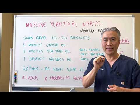 Massive Plantar Wart🦶🦶-----Natural