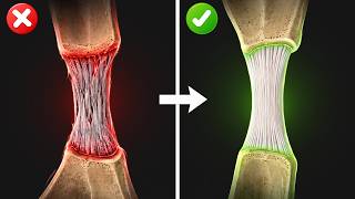 90% of Tendon Problems Start HERE
