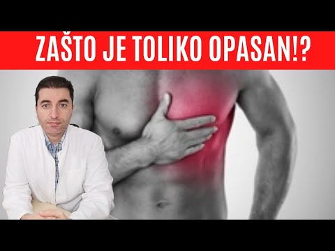 Video: Dirofilarijaza Kod Ljudi - što Je To: Simptomi I Liječenje