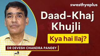 Daad-Khaj Khujli: Kya hai Ilaj | Ringworm / Skin Infection: Treatment | Dr Devesh Chandra Pandey