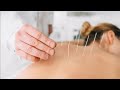 Tams acupuncture introduction acupuncture treatment  acupressure points  magnet dr dk raj