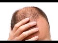 Как избавиться от облысения и седых волос
