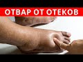 МОЩНЫЙ ОТВАР от ОТЕКОВ