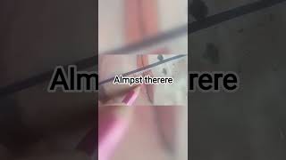##artt##