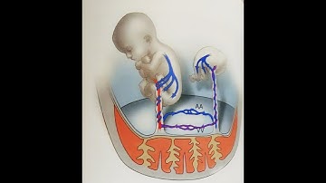 TWIN PREGNANCY [ANTENATAL MANAGEMENT AND COMPLICATIONS OF MONOCHORIONIC TWINS]