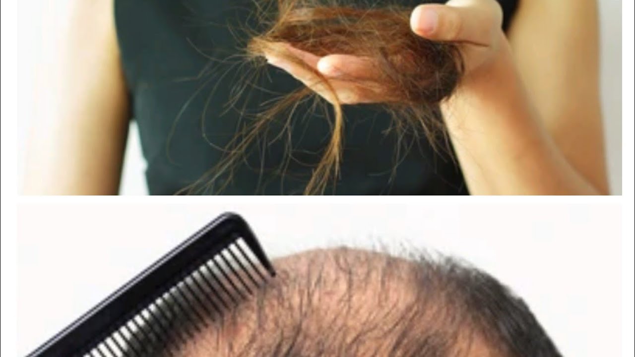 How to Stop hair fall YouTube