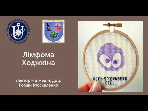 Лімфома Ходжкіна