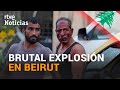 Hablamos con un TESTIGO de la FUERTE EXPLOSIÓN EN BEIRUT, LÍBANO | RTVE