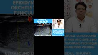 #ultrasound #Epididymitis #funiculitis #foryou #fup #fyp #radiologystudent #youtube #fypage #viral