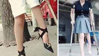 Beautiful Girl Has Very Short Leg And Walks With Crutches(5)😍❤️#Crutches #Amazing #Polio #Short_Leg