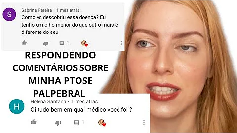 O que fazer quando se tem um olho maior que o outro?