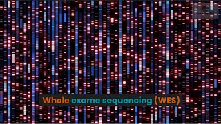 Whole exome sequencing (WES)