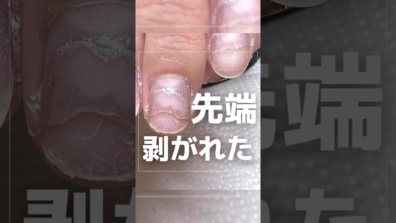 TAT - ネイルパフェ - ネイルリペアベース