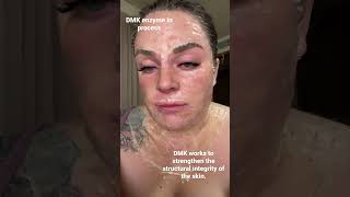 DMK enzyme magic #dmk #dmkenzyme #esthetician DMK enzyme magic #dmk #dmkenzyme #esthetician