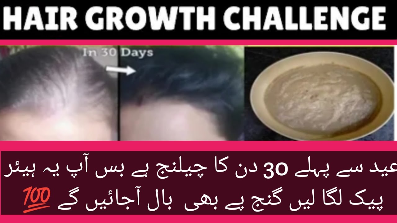 Turn Thin Hair To Thick Hair In 30 Days | Hair Growth Miracle Treatment ...