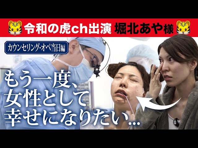 美容整形版令和の虎】もう一度女性として幸せになりたい...骨切り手術 