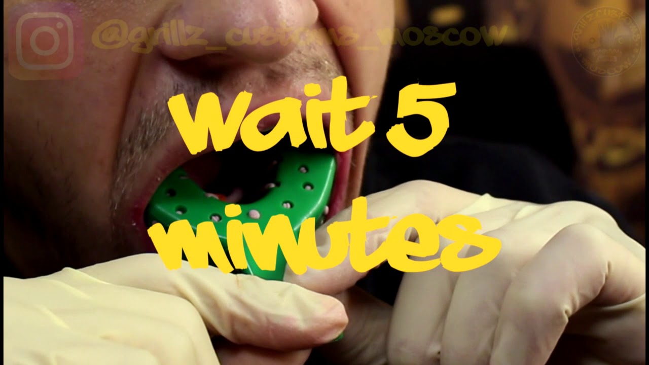 Слепок(оттиск) для Grillz.Teeth impression for Grillz