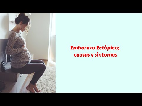 Vídeo: Embarazo Ectópico: Síntomas, Causas Y Tratamientos