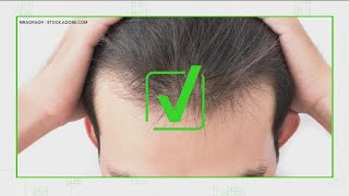 VERIFY: Is hair loss a lasting symptom of COVID-19?