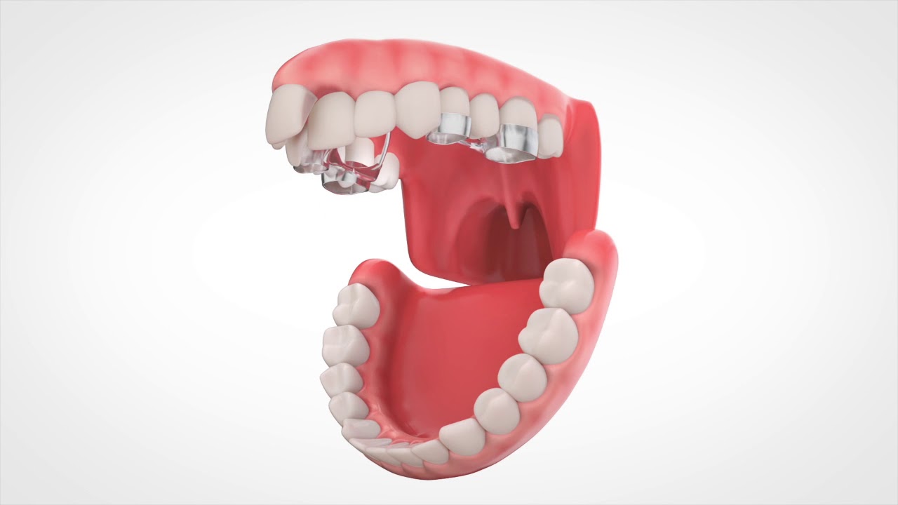 PowerScrew Animation 201708 YouTube